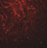 LIN28A Polyclonal Antibody