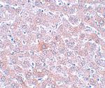 RSRC1 Polyclonal Antibody