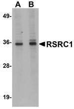 RSRC1 Antibody in Western Blot (WB)