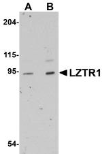 LZTR1 Antibody in Western Blot (WB)