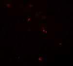 BCAS3 Polyclonal Antibody