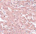 BCAS4 Antibody in Immunohistochemistry (IHC)