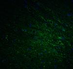 DCLK1 Polyclonal Antibody