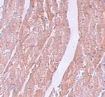 MINA53 Polyclonal Antibody