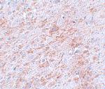 DCAMKL2 Polyclonal Antibody