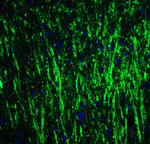 DCLK3 Polyclonal Antibody