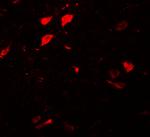 DCLK3 Antibody in Immunohistochemistry (IHC)