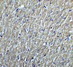 DCLK3 Antibody in Immunohistochemistry (IHC)