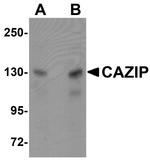 CAZIP Antibody in Western Blot (WB)