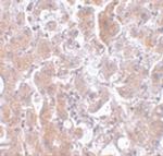 ELOVL7 Polyclonal Antibody
