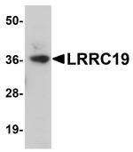 LRRC19 Antibody in Western Blot (WB)