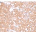 TMEM70 Polyclonal Antibody