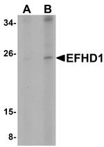 EFHD1 Antibody in Western Blot (WB)