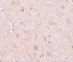 EFHD2 Polyclonal Antibody