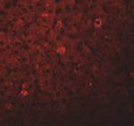 LYRM1 Antibody in Immunohistochemistry (IHC)