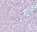 LYRM1 Polyclonal Antibody