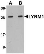 LYRM1 Antibody in Western Blot (WB)