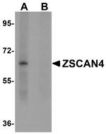 LYRM2 Antibody in Western Blot (WB)