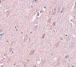 ZC3H12B Polyclonal Antibody