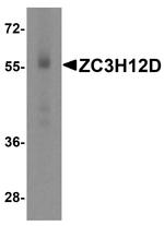 ZC3H12D Antibody in Western Blot (WB)