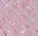 RANBP10 Polyclonal Antibody