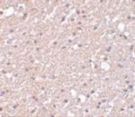 TMEM184A Polyclonal Antibody