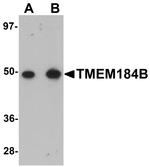 TMEM184B Antibody in Western Blot (WB)