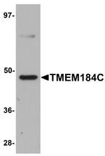 TMEM184C Antibody in Western Blot (WB)
