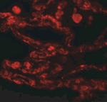 CCDC69 Antibody in Immunohistochemistry (IHC)