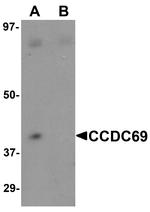 CCDC69 Antibody in Western Blot (WB)