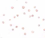 DCAF12 Polyclonal Antibody