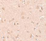 NSA2 Polyclonal Antibody
