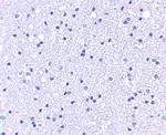 APC1 Antibody in Immunohistochemistry (IHC)
