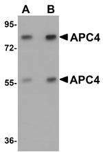 APC4 Antibody in Western Blot (WB)