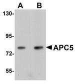 APC5 Antibody in Western Blot (WB)