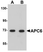 APC6 Antibody in Western Blot (WB)