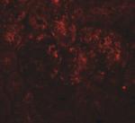 PIAS1 Antibody in Immunohistochemistry (IHC)