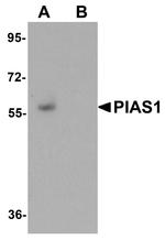 PIAS1 Antibody in Western Blot (WB)