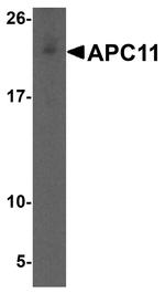 APC11 Antibody in Western Blot (WB)