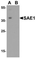 SAE1 Polyclonal Antibody