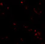 UBA2 Antibody in Immunocytochemistry (ICC/IF)