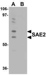 UBA2 Antibody in Western Blot (WB)