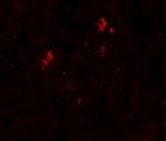 SUMO2/SUMO3 Antibody in Immunohistochemistry (IHC)