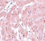 SUMO2/SUMO3 Polyclonal Antibody
