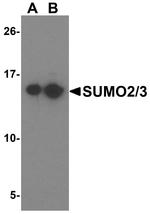 SUMO2/SUMO3 Antibody in Western Blot (WB)