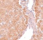 SUMO-3 Polyclonal Antibody