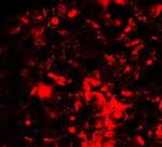 RNF8 Polyclonal Antibody