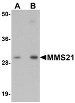 NSE2 Polyclonal Antibody