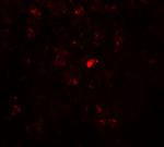 CtIP Antibody in Immunohistochemistry (IHC)