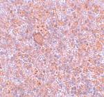 CtIP Antibody in Immunohistochemistry (IHC)